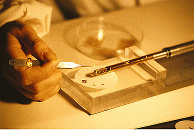 控尿计划表：中老年尿控困扰？神奇“计划表”来帮忙-3